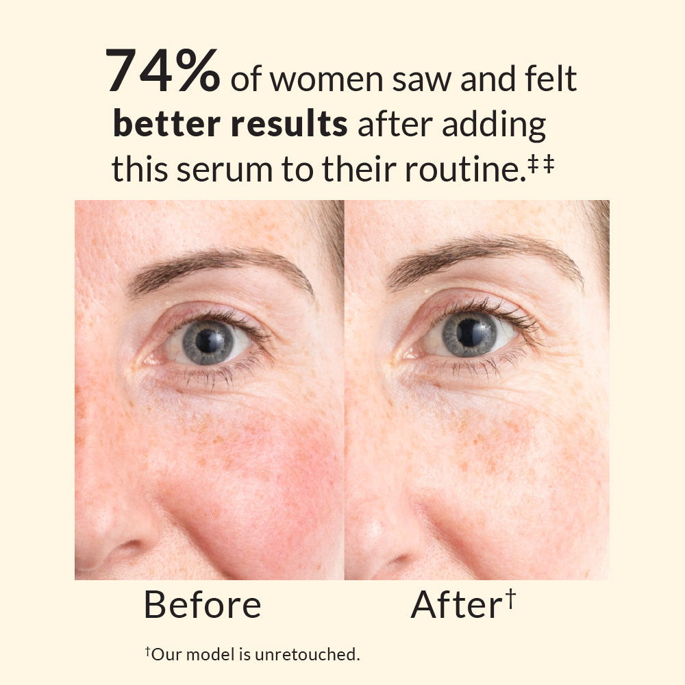 Avon Anew Skin Renewal Power Serum – 30ml